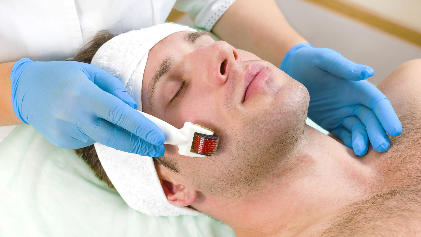 Micro Needling